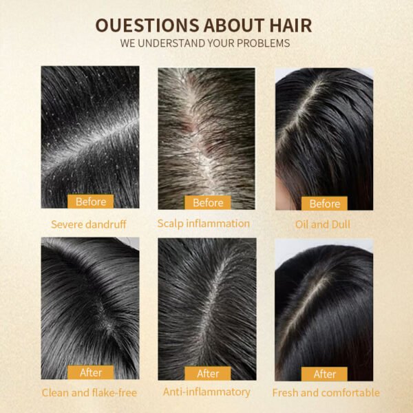 KIZEAUT Ginger Anti Hair Loss Anti-Dandruff Shampoo