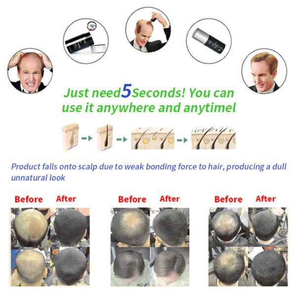 KIZEAUT Hair Building Fibers For Hairline Lossa