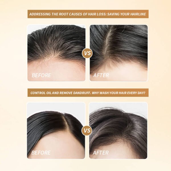 KIZEAUT Anti-Hair Loss Shampoo 300ml