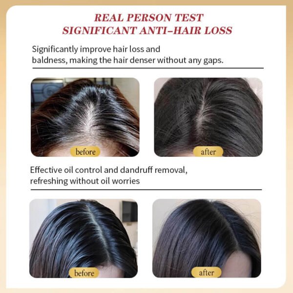 KIZEAUT Golden Caviar Shampoo | Effectively Remove Dandruff & Repair Damaged Hair
