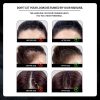 KIZEAUT Hair Building Fibers For Hairline Loss