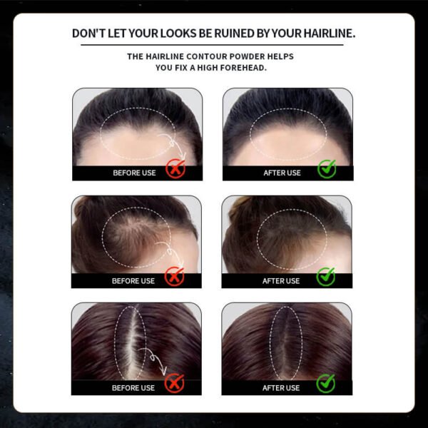 KIZEAUT Hair Building Fibers For Hairline Lossa