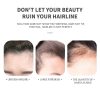KIZEAUT Hairline Shadow Powder, Scalp Line Filler for Forehead & Sideburns, Creates Voluminous & Full Hair Look