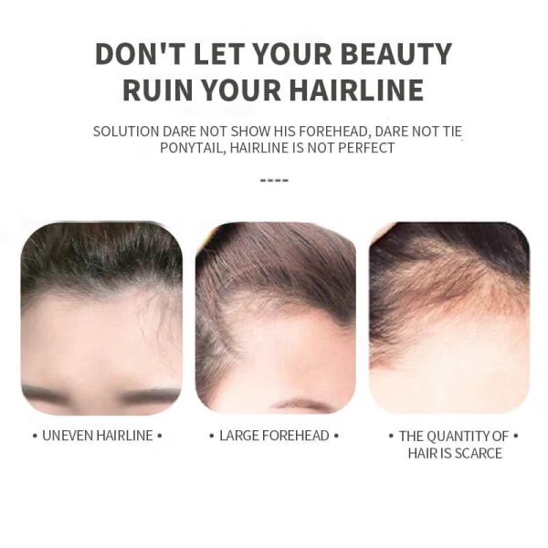 KIZEAUT Hairline Shadow Powder, Scalp Line Filler for Forehead & Sideburns, Creates Voluminous & Full Hair Look