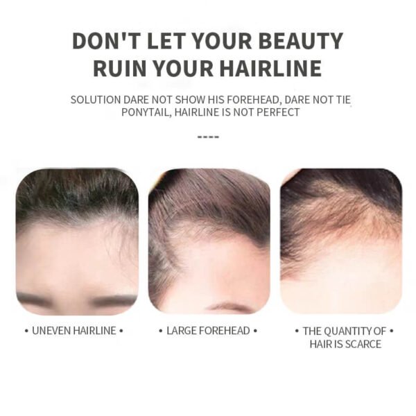 KIZEAUT Hairline Shadow Powder, Scalp Line Filler for Forehead & Sideburns, Creates Voluminous & Full Hair Look